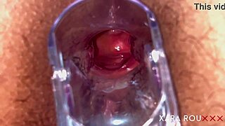 hey, check out this anal speculum on a huge bbw slut 😏 tight and hairy