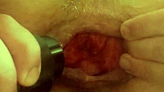 Big Anal Lips Sucked By Vacuum While Jerking Off Prolapse