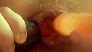 Big Anal Lips Sucked By Vacuum While Jerking Off Prolapse